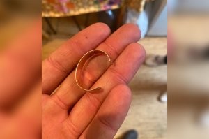 Как снять кольцо с опухшего пальца