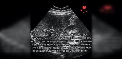 Беременность: мемы и комментарии, которые лучше всего описывают непростую ситуацию