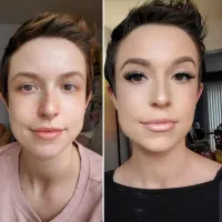 И за 15 минут септум исчез?