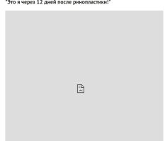 больше половины фоток такие