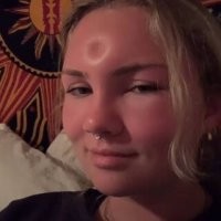 >> Девушка в приспособлении, которое помогает создать ямочки на щеках
И на лбу?