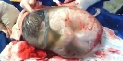 Плацента вместе с оболочками плода (так называемый послед) у женщины выходит из половых путей через 5 60 минут (в зависимости от тактики ведения родов) в последовом периоде родов, после рождения ребёнка. Так значит Ребенок находится непосредственно в матке а не в плаценте переходящей в оболочки плода ?  Прям в матке лежит ))  Молодец, такой тупой звезды как ты я ещё не встречал .  ты уникум.  Так в чем эта личинка ?? В матке ???
