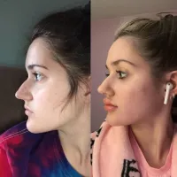 Была нормальной девкой, стала тупой уткой