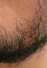 Ну это не новость, что у человека волосы разного цвета. Я находил у себя на голове абсолютно чёрные волосы, хотя в общем и целом не брюнет.