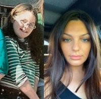 И от синдрома Дауна излечилась.