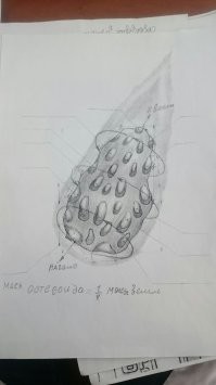 Это западная версия болезни, российская выглядит так: