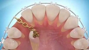 Вот нашел в интернете - это страндартная методика