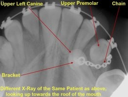 Вот нашел в интернете - это страндартная методика