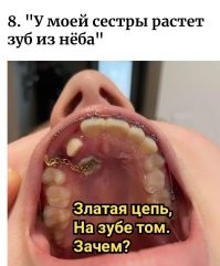 30 омерзительных фото, которые хочется немедленно развидеть