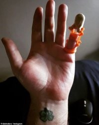 Чё, мизинец новый надо? Вот х@й тебе, а не мизинец!