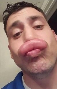 Экскаваторщик пожалел, что потревожил шершней