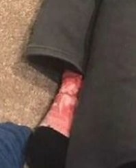 Пока он спал, ее кто-то обглодал.