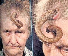 140-летний йеменец умер после удаления рогов. Говорят, они выросли после сделки с Дьяволом