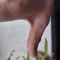 Было с чаем. Нёс кипяток в комнату попить на ступеньке из кухни споткнулся и пролил на руку. Бросил кружку, но руку обварил конечно. Только зажило более менее.