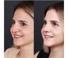 Точно, пусть остаются страшные, но зато аутентичные.

Вы ж сам наверняка хотели бы себе левую аутентичность, а не правую кукольность и безликость.