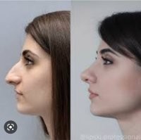 Точно, пусть остаются страшные, но зато аутентичные.

Вы ж сам наверняка хотели бы себе левую аутентичность, а не правую кукольность и безликость.