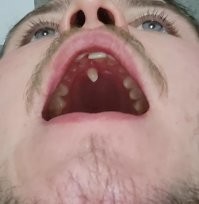 19 любопытных случаев, когда генетика подарила людям необычные фишки внешности