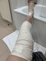 Когда то увлекался и горным туризмом и альпинизмом , был у нас мужик тренер беспалый , на руке только несколько пальцев , ноги не видел не знаю , всегда в ботинках ходил , так ему было все равно куда и когда идти . Я свои разряды заработал и сдал их отлично , после травмы в горы хожу теперь как турист и иногда сам по себе , да и лыжи и сноуборды дают о себе знать , уже не мальчик бегать прыгать , то там кольнуло то там . Последнее мое катание ( нормальное катание ) закончилось так , ноги вправили и все такое , и через сутки я опять на склоне , докторша которая вправляла подбежала и говорит ты что совсем на голову отмороженный , мы тебе сказали минимум месяц :)