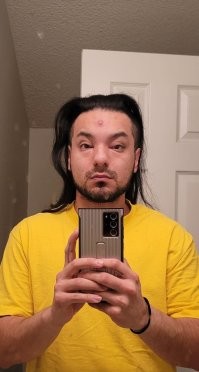 Небольшой нарыв на лбу, может превратить Вас в Шанг Цунга.