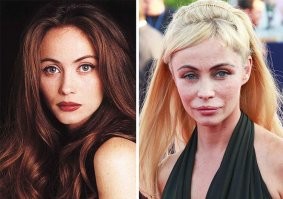 Я понимаю, конечно, что реклама - двигатель торговли.
Но, смельчакам, желающим стать как Питт или Джоли, не стоит забывать о том, что далеко не факт, что операция будет удачной. Даже если нет проблемы с деньгами.