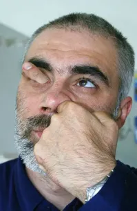 К каким последствиям может привести привычка ковырять в носу