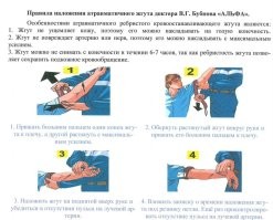 Странно, но у нас тренинги с жгутом Бубнова. Да и все наши аптечки этим же жгутом снабжены.
 А эта "древность" Эсмарха до сих пор в армии?