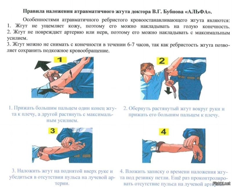 Странно, но у нас тренинги с жгутом Бубнова. Да и все наши аптечки этим же жгутом снабжены.
 А эта "древность" Эсмарха до сих пор в армии?