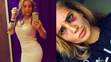 Они хорошенькие до боя на фотосессии. Потом бывает так: