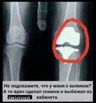 Фотограф с помощью рентгеновских снимков показал «начинку» современной техники