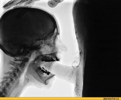 Имхо, это называется "компьютерная графика" (ней-ро-сеть! ней-ро-сеть!). Слишком ярко, слишком контрастно.
Простите, не удержался.