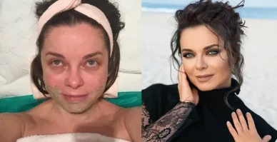 14 людей, которые решились на пластику - и вообще не пожалели