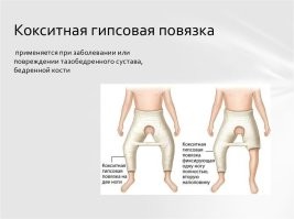 Помнится, было. 1975 год. Фильм "Неуловимые мстители" уже все посмотрели. А в колхозах ещё лошади водились. Так, больше что б поржать. На полях уже техника работала. Вот один ковбой насмотрелся, как Данька за Лютым гнался, а перед этим с крыши на коня спрыгивал. Ну конифаций такой стоит себе в теньке. Жуёт чо то там. А на его худющую спину без седла ковбой с какой то верхотуры та-дах! Кости таза разошлись. А при таких делах накладывают гипс вот таким вот макаром. И долго лежать в позе лягухи.