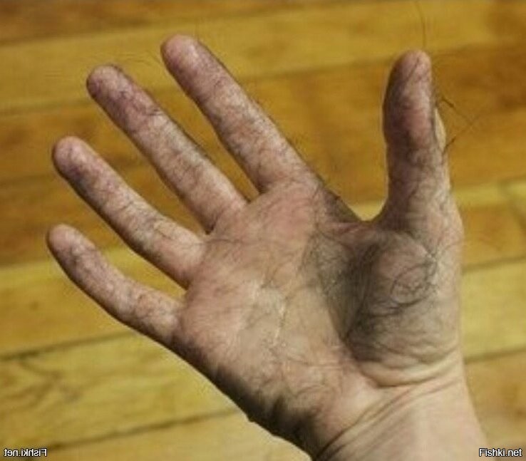 "шутят, что на ладонях волосы растут от мастурбации..."

Да уж какие тут шутки...