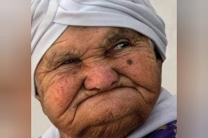 Я имел ввиду форма лица, ну в принципе форма черепа за счет выпадения зубов и искривления челюсти тоже может измениться)