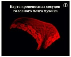 14 фото работы мозга, которые показывают, как выглядит то, что происходит у нас в голове