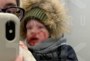 Сколько ещё человек должно пострадать, пока кретины поймут , что средневековье кончилось и держать в городе зверинец уже необязательно?
Город для людей! Весь зверинец в зоопарк вместе с привязанными на веревочку к псам тупыми хозяевами.

Даже если один человек пострадал это уже поводсделать выводы и принять решение.
А это происходит систематически, нет ни одного города где бы не происходили нападения.  Псина прошла сотни лет отбора для повышения боевых качеств. Её назначение - нападать, отпугивать лаем, рвать врага, защищать хозяина клыками.
Для любителей охотничьих пород - на кого собирались охотится? В городе...