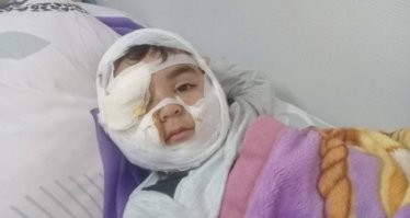 Сколько ещё человек должно пострадать, пока кретины поймут , что средневековье кончилось и держать в городе зверинец уже необязательно?
Город для людей! Весь зверинец в зоопарк вместе с привязанными на веревочку к псам тупыми хозяевами.

Даже если один человек пострадал это уже поводсделать выводы и принять решение.
А это происходит систематически, нет ни одного города где бы не происходили нападения.  Псина прошла сотни лет отбора для повышения боевых качеств. Её назначение - нападать, отпугивать лаем, рвать врага, защищать хозяина клыками.
Для любителей охотничьих пород - на кого собирались охотится? В городе...