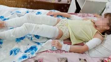 Сколько ещё человек должно пострадать, пока кретины поймут , что средневековье кончилось и держать в городе зверинец уже необязательно?
Город для людей! Весь зверинец в зоопарк вместе с привязанными на веревочку к псам тупыми хозяевами.

Даже если один человек пострадал это уже поводсделать выводы и принять решение.
А это происходит систематически, нет ни одного города где бы не происходили нападения.  Псина прошла сотни лет отбора для повышения боевых качеств. Её назначение - нападать, отпугивать лаем, рвать врага, защищать хозяина клыками.
Для любителей охотничьих пород - на кого собирались охотится? В городе...