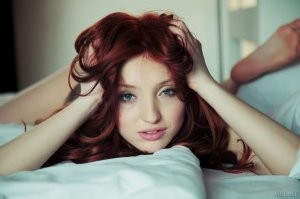 Интересные факты о веснушках