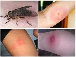 Хе.. На рыбалке летом комары ещё не самое страшное. У нас на Урале их называют "пауты". По научному - оводы и слепни.