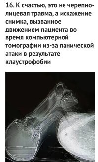 Да знаем мы чей это рентген