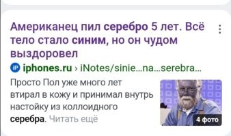 У Карасона диагностировали аргироз – болезнь, причиной которой становится отложение серебра в организме. Появился такой недуг после лечения сильного дерматита. Мужчина сам изготовил протеинат серебра из металла и дистиллированной воды. Вместе с тем он применял бальзам с коллоидным серебром, который считают антибактериальным