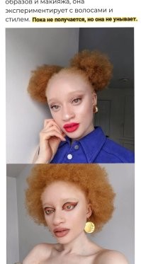 Необычные гены: западноафриканская модель с альбинизмом