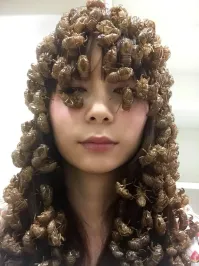 Запущенный случай педикулёза.