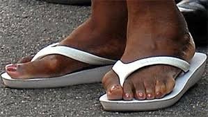 Порылся в интернете и нашёл фото поудачнее. Но дефект в любом случае не особо бросается в глаза. У некоторых шишка в этой области больше. Забыл как она называется)