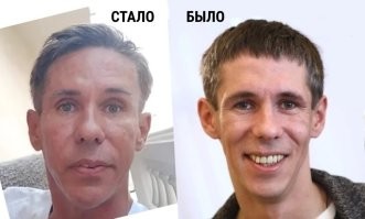 Таки он сделал себе пластику  Помню, в одном из последних постов с ним меня за это предположение заминусили, а я отчётливо помню, что у него были нависшие веки. А теперь...