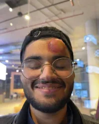 Это не оператор, это мазохист какой-то. Судя по его довольной роже, он башкой об стенку бился и приговаривал "бей меня, бей, противный рональдо, избей меня полностью". В жизнь не поверю, что волдырь на его бестолковке - от футбольного мяча.