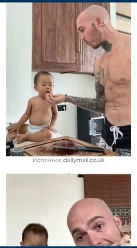 У него от сырого мяса, большая часть волос к 31 году вылезла?