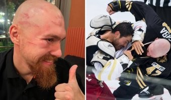 Шрам на всю жизнь? Ещё скажите что этих мужиков такое пугает ))
Верба так вообще как медали их носит. Кстати, вставные передние зубы это тоже на всю жизнь, уважаемый товарищ тренер ))