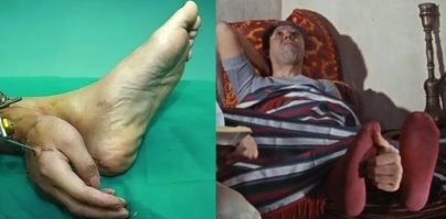 А чё, класс, можно пятку почесать не сгибаясь!